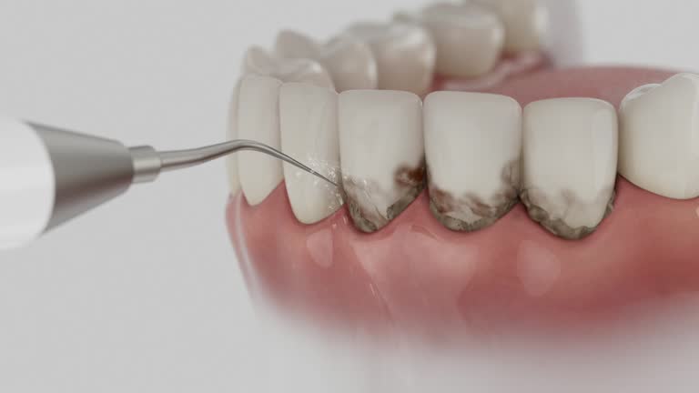 Reliable Dental Implants contractor in Keyes, CA by Smile Center Dentistry